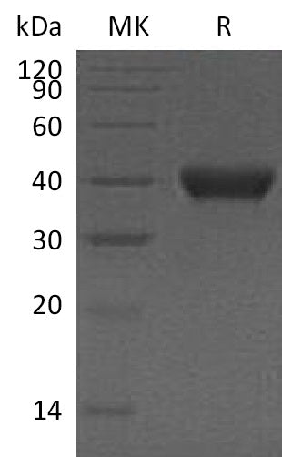 Recombinant Human RNASE T2 (C-6His)