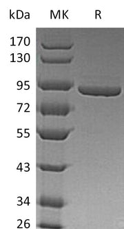 Recombinant Human PFKM (C-6His)