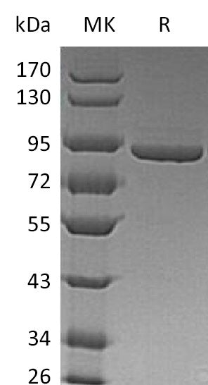 Recombinant Human PFKM (C-6His)