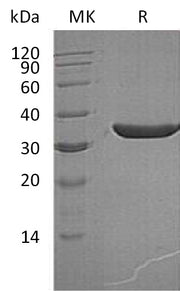 Recombinant Human KLK3 (236AA, C-6His)