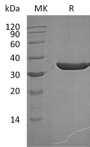 Recombinant Human KLK3 (236AA, C-6His)
