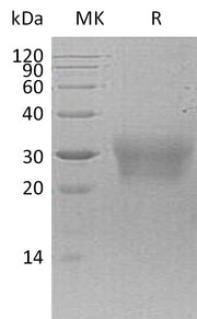 Recombinant Human NPDC1 (C-6His)