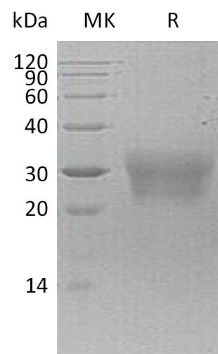 Recombinant Human NPDC1 (C-6His)