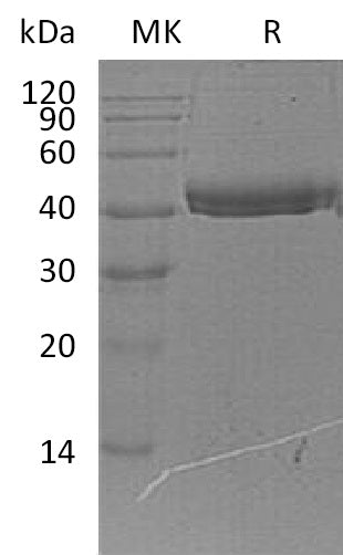 Recombinant Human COL9A1 (C-6His)