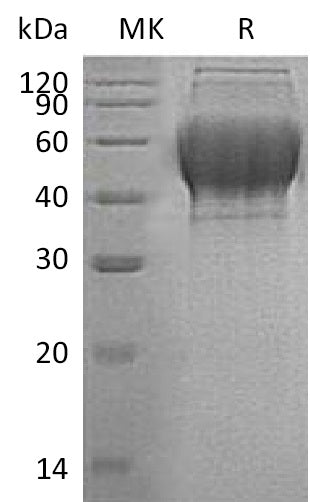 Recombinant Human TXNDC15 (C-6His)