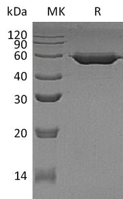 Recombinant Human AMY2B (C-6His)
