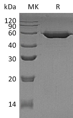 Recombinant Human AMY2B (C-6His)