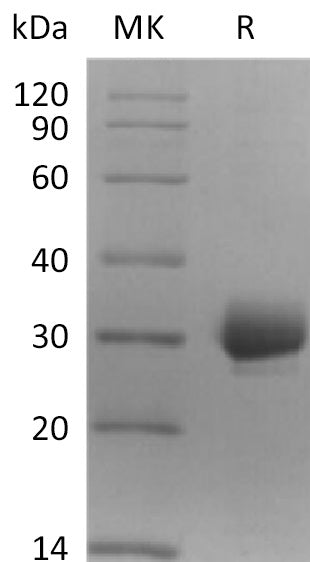 Recombinant Human CCDC134 (C-6His)