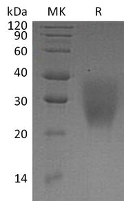 Recombinant Human LRRC25 (C-6His)