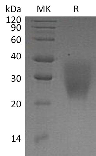 Recombinant Human LRRC25 (C-6His)