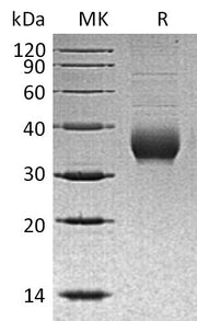 Recombinant Human CHRNB3 (C-6His)