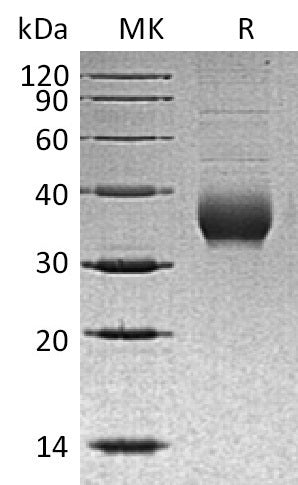 Recombinant Human CHRNB3 (C-6His)