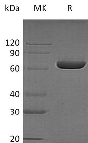 Recombinant Human LTA4H (C-6His)