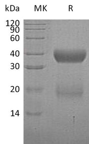 Recombinant Human VSTM2A (C-6His)