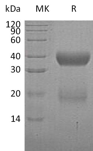 Recombinant Human VSTM2A (C-6His)
