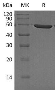 Recombinant Human PFKFB1 (C-6His)