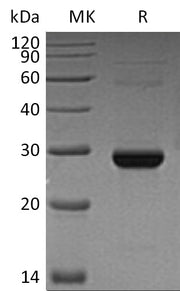 Recombinant Human TK1 (C-6His)