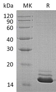 Recombinant Human CST3 (C-6His)