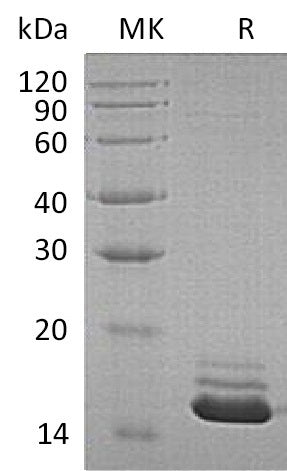 Recombinant Human CST3 (C-6His)