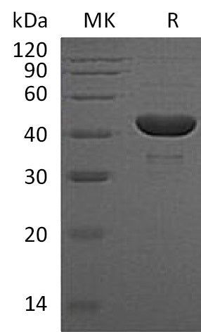 Recombinant Human PGK1 (C-6His)