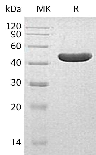 Recombinant Human INPP5A (C-6His)