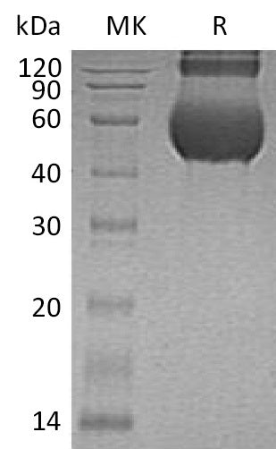 Recombinant Human CDCP1 (C-6His)