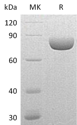 Recombinant Mouse SEMA4A (C-6His)