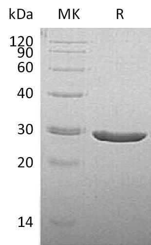 Recombinant Human TPK1 (C-6His)