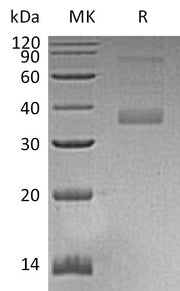 Recombinant Human MFAP4 (C-6His)