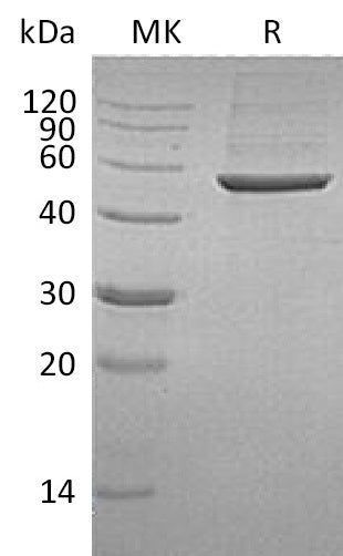 Recombinant Human 6PGD (C-6His)