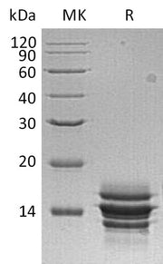 Recombinant Human CXCL7 (C-6His)