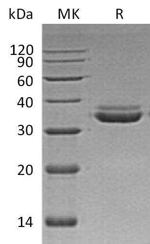 Recombinant Human LMAN2L (C-6His)