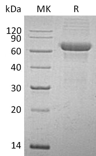 Recombinant Human SCG3 (C-6His)