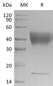 Recombinant Human IFNGR1 (C-6His)