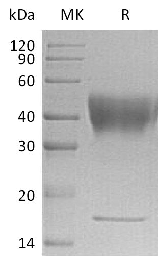 Recombinant Human IFNGR1 (C-6His)