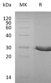 Recombinant Human DTD1 (C-6His)