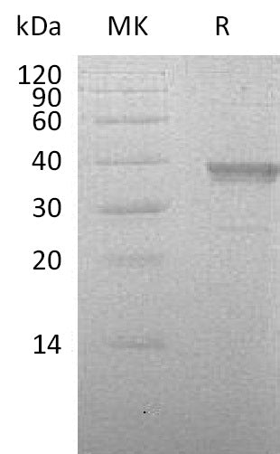 Recombinant Human HABP2 (C-6His)
