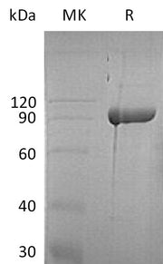 Recombinant Human ABP1 (C-6His)