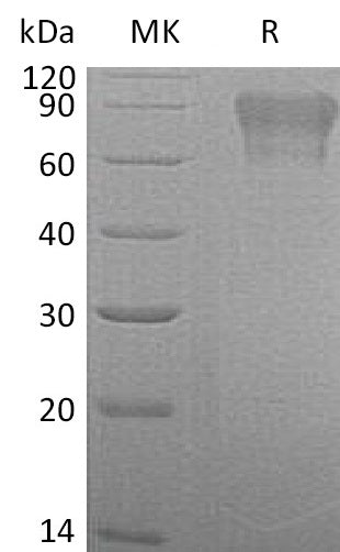 Recombinant Human Factor IX (C-6His)