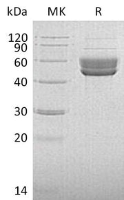 Recombinant Human Serpin I2 (C-6His)