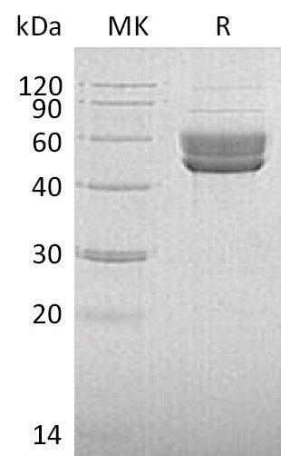Recombinant Human Serpin I2 (C-6His)