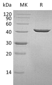 Recombinant Human SEPHS1 (C-6His)