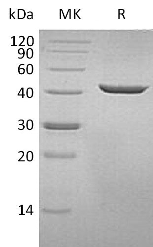 Recombinant Human SEPHS1 (C-6His)
