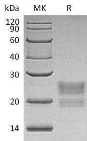 Recombinant Human MPZL1 (C-6His)