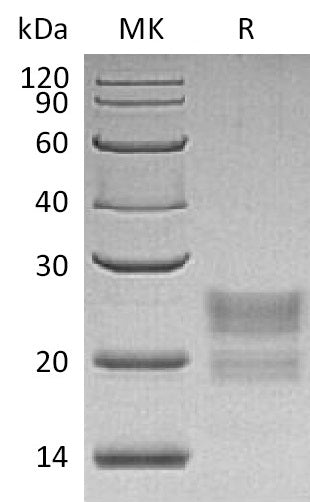 Recombinant Human MPZL1 (C-6His)