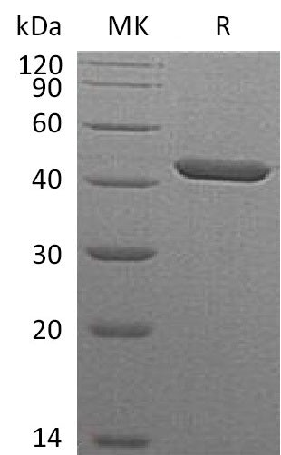 Recombinant Human Serpin B1 (C-6His)