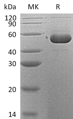 Recombinant Human Serpin B12 (C-6His)