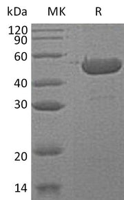 Recombinant Human SHPK (C-6His)