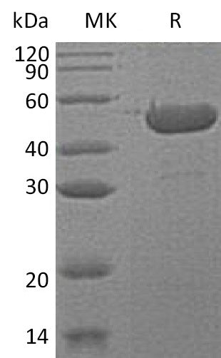 Recombinant Human SHPK (C-6His)