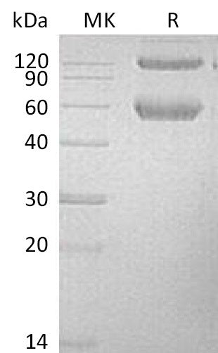 Recombinant Mouse BMPR1A (C-Fc-6His)